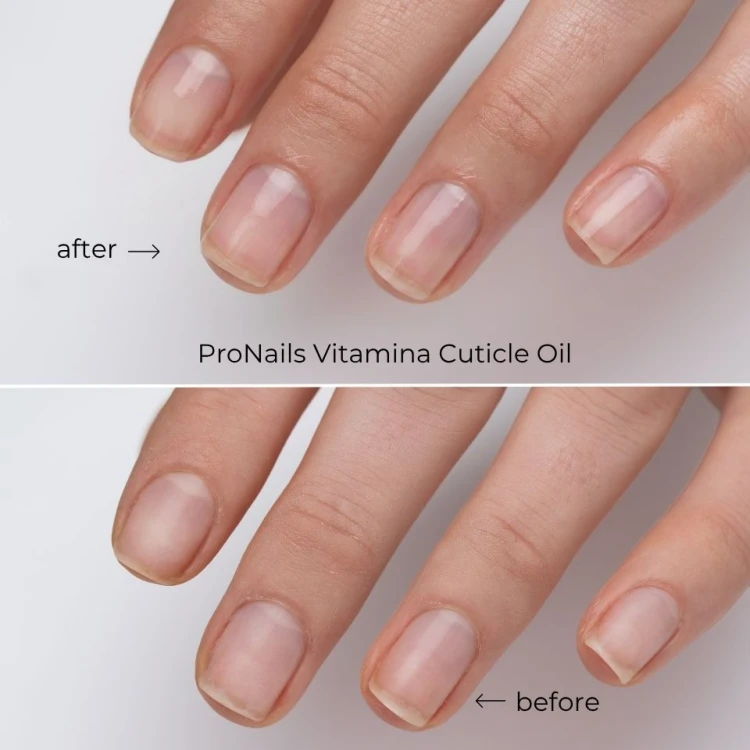 ProNails Vitamina Cuticle Oil Nowa linia Nail Care Before and after.jpg