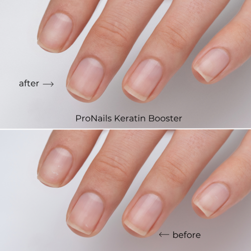 ProNails Nowa linia Nail Care (1).png