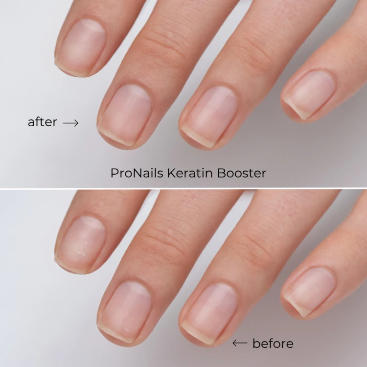 ProNails Nowa linia Nail Care (1).png