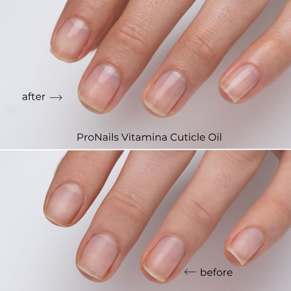 ProNails Vitamina Cuticle Oil Nowa linia Nail Care Before and after.jpg