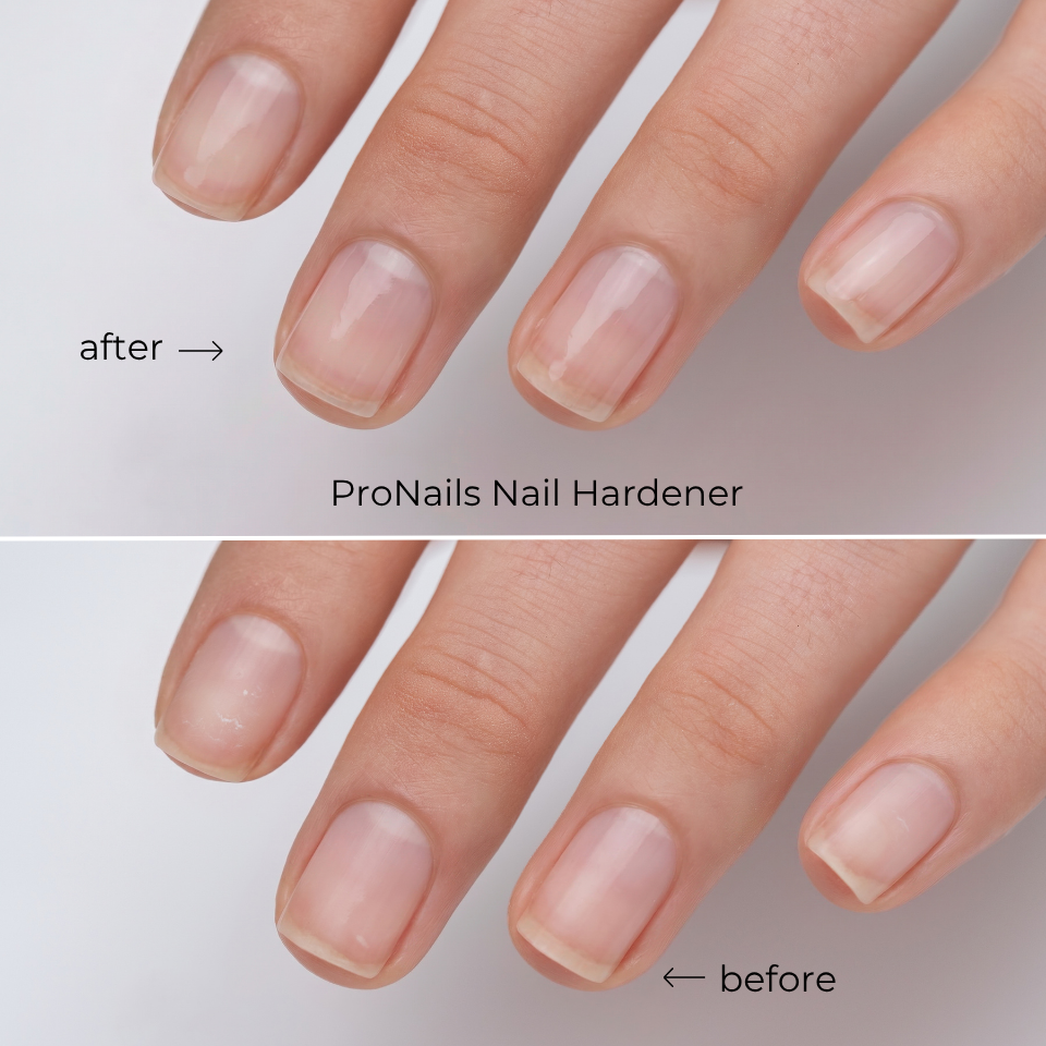 ProNails Nowa linia Nail Care (2).png