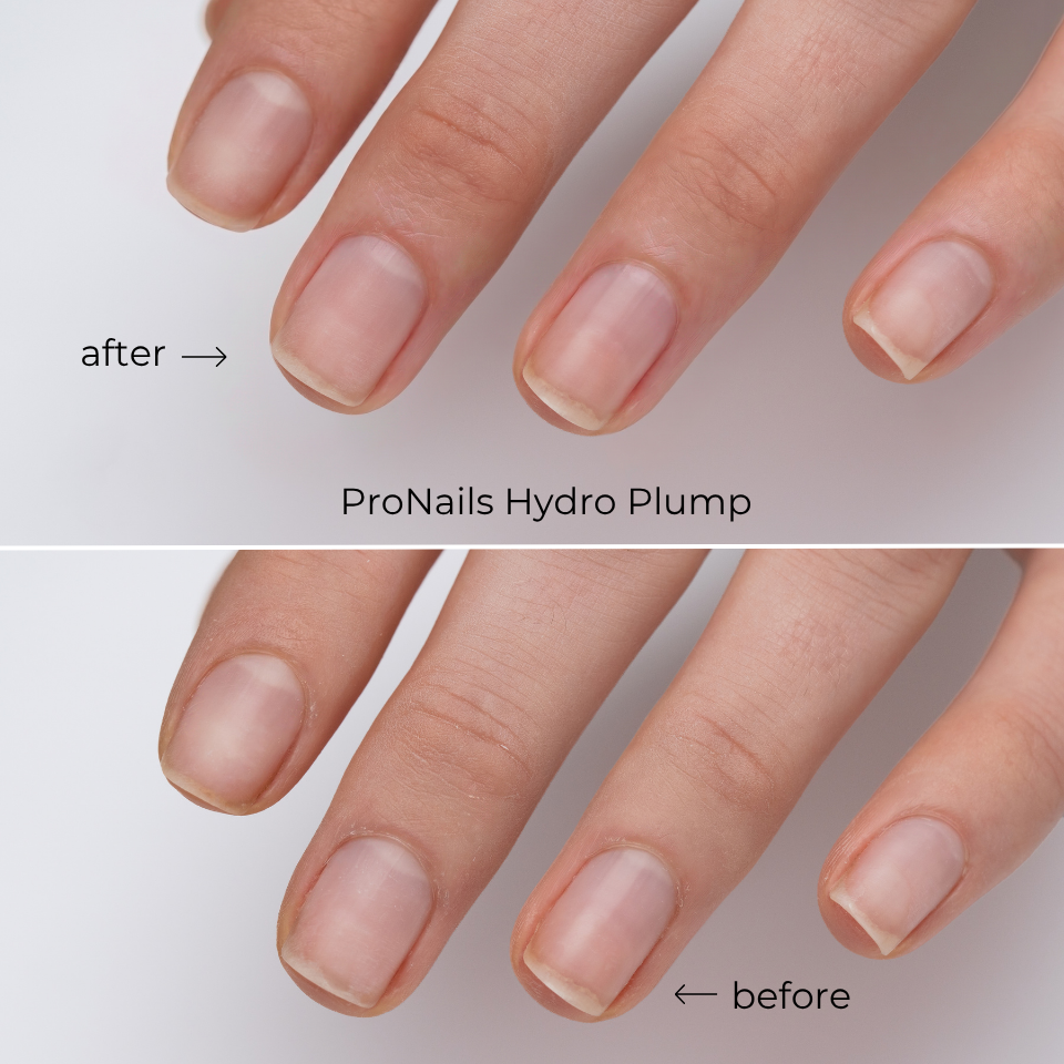 ProNails Nowa linia Nail Care (4).png
